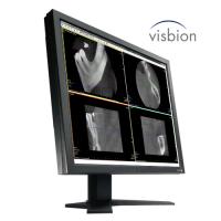 Visbion IPACS for Dental 3D