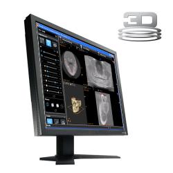 KDIS 3D CBCT Viewing and Planning Software v2.4
