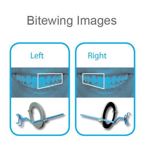 Denbite Digital Intra-Oral Sensor Holder - Size 2 Bitewing (x10)