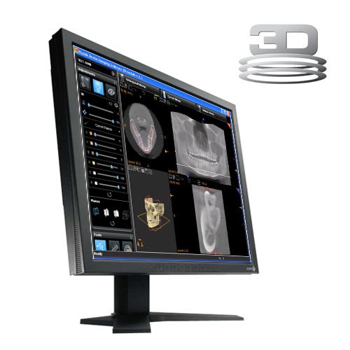Carestream 3D CBCT Viewing and Planning Software v3.1